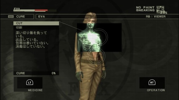 EVAを治療