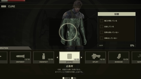 治療のやり方